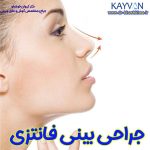 جراحی بینی فانتزی (عروسکی)