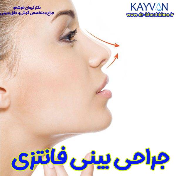 جراحی بینی فانتزی (عروسکی)