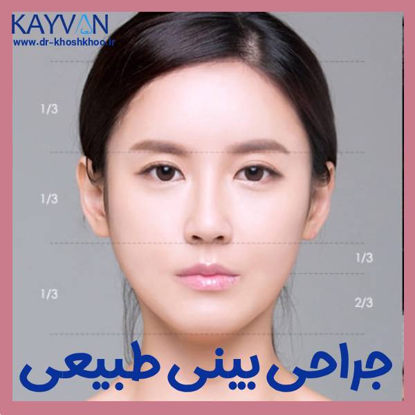 جراحی بینی طبیعی - دکتر کیوان خوشخو