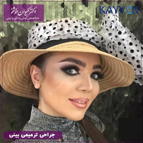 جراحی ترمیمی بینی - دکتر کیوان خوشخو
