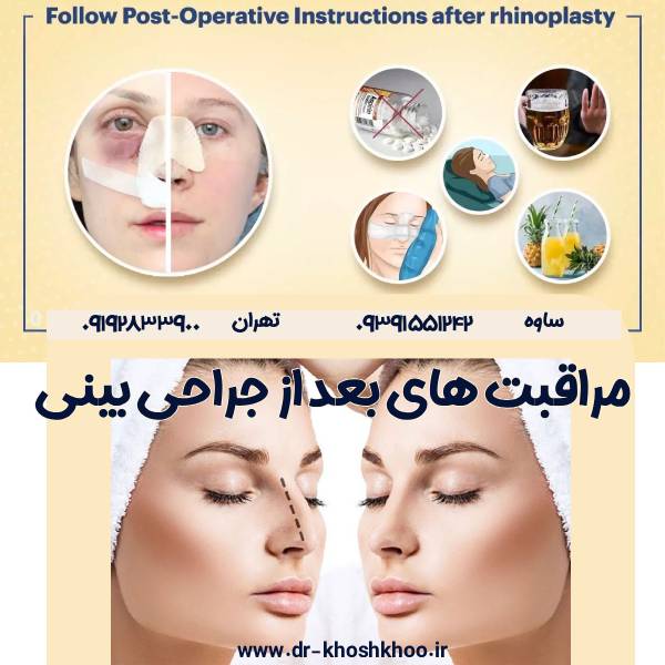 مراقبت های بعد از جراحی بینی - دکتر کیوان خوشخو