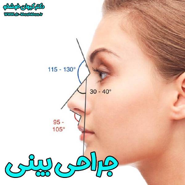 جراحی بینی تهران - دکتر کیوان خوشخو