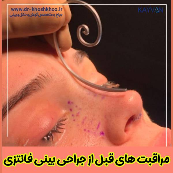 مراقبت‌ های قبل از جراحی بینی فانتزی