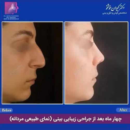 عمل-بینی-تهران-126