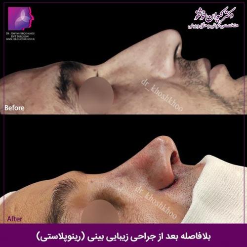 عمل-بینی-تهران-139